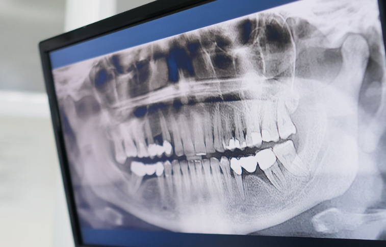 5. Radiācijas drošība medicīnā, Zobārstniecība